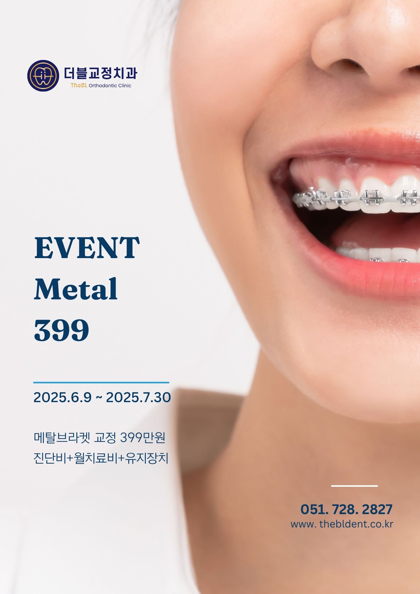 메탈교정399
